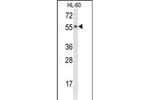 Western blot analysis of NYX Antibody (N-term) (ABIN653436 and ABIN2842877) in HL-60 cell line lysates (35 μg/lane). (Nyctalopin antibody  (N-Term))