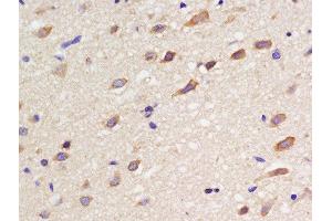 Formalin-fixed and paraffin embedded rat brain labeled with Rabbit Anti-SSTR3 Polyclonal Antibody, Unconjugated  at 1:200 followed by conjugation to the secondary antibody and DAB staining (SSTR3 antibody)