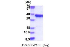 SDS-PAGE (SDS) image for Pyrophosphatase 2 (PPA2) (AA 33-334) protein (His tag) (ABIN5853823)