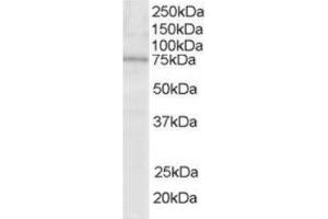 Image no. 1 for anti-Lymphocyte Cytosolic Protein 2 (SH2 Domain Containing Leukocyte Protein of 76kDa) (LCP2) (N-Term) antibody (ABIN374443) (LCP2 antibody  (N-Term))