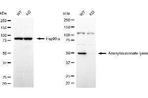 Western blotting analysis using adenylosuccinate lyase antibody (ABIN7797524).
