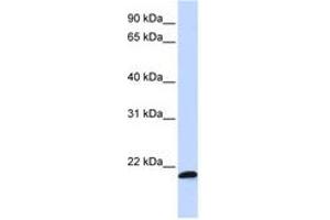 Image no. 1 for anti-Chromosome 21 Open Reading Frame 56 (C21orf56) (AA 108-157) antibody (ABIN6740942) (C21ORF56 antibody  (AA 108-157))