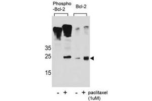 Western blot analysis of extracts from Jurkat cells, untreated or treated with Paclitaxel, using phospho Bcl-2 antibody (left) or nonphos Ab (right). (Bcl-2 antibody  (pSer70))