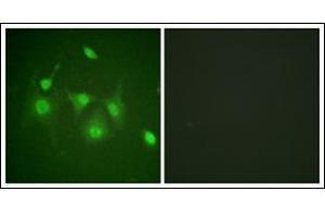 Immunofluorescence analysis of HepG2 cells, using HDAC6 Antibody. (HDAC6 antibody  (N-Term))