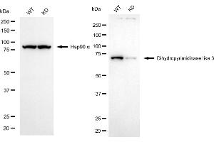 Western blotting analysis using dihydropyrimidinase like 3 antibody (ABIN7798338). (Recombinant DPYSL3 antibody)