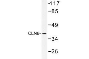 Image no. 1 for anti-Ceroid-Lipofuscinosis, Neuronal 6, Late Infantile, Variant (CLN6) antibody (ABIN317825) (CLN6 antibody)