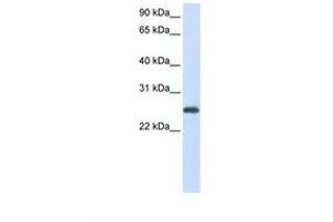 Image no. 1 for anti-Peroxiredoxin 1 (PRDX1) (N-Term) antibody (ABIN6738463) (Peroxiredoxin 1 antibody  (N-Term))