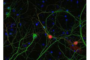 Indirect immunostaining of PFA fixed rat hippocampus neurons with anti-calbindin (dilution 1 : 5000; red) and mouse anti-MAP 2 (, dilution 1 : 1000; green).