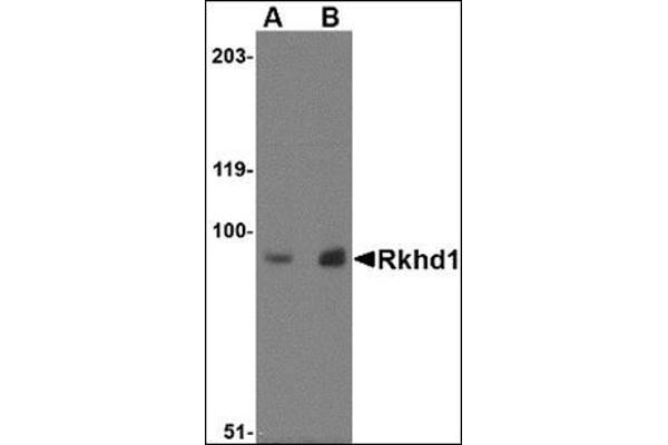 MEX3D antibody  (Center)