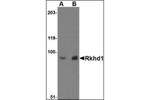 Western blot analysis of Rkhd1 in MDA-MB-361 cell lysate with this product at (A) 1 µg/ml and (B) 2 μg/ml. (MEX3D antibody  (Center))