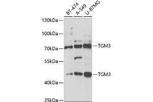 Western blot analysis of extracts of various cell lines, using TGM3 antibody (ABIN6132263, ABIN6149094, ABIN6149095 and ABIN6221560) at 1:1000 dilution. (TGM3 antibody  (AA 1-180))