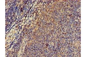 Immunohistochemistry of paraffin-embedded human lymph node tissue using ABIN7146620 at dilution of 1:100 (PRKAR2A antibody  (Regulatory Subunit))