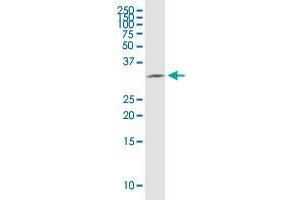 HSD17B12 monoclonal antibody (M08), clone 4G11.