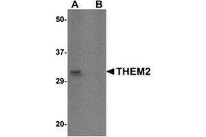 Western blot analysis of THEM2 in HepG2 cell lysate with this product at 1 μg/ml in (A) the absence and (B) the presence of blocking peptide.