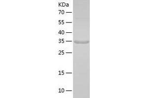 Western Blotting (WB) image for Amnionless (AMN) (AA 20-357) protein (His tag) (ABIN7288655) (AMN Protein (AA 20-357) (His tag))