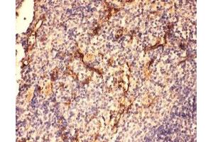 IHC-P: C5a antibody testing of mouse spleen tissue (C5A antibody  (N-Term))