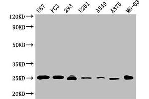 Western Blot Positive WB detected in: U87 whole cell lysate, PC3 whole cell lysate, 293 whole cell lysate, U251 whole cell lysate, A549 whole cell lysate, A375 whole cell lysate, MG-63 whole cell lysate All lanes CD9 antibody at 1:2000 Secondary Goat polyclonal to mouse IgG at 1/50000 dilution Predicted band size: 25 KDa Observed band size: 25 KDa Exposure time:5 min (CD9 antibody  (AA 112-195))