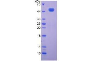 Image no. 1 for Complement Component C9 (C9) (AA 136-512) protein (His tag) (ABIN6237983)