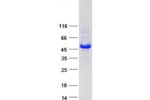 Validation with Western Blot
