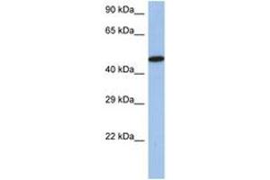 Image no. 1 for anti-Interferon Regulatory Factor 5 (IRF5) (AA 395-444) antibody (ABIN6742243) (IRF5 antibody  (AA 395-444))