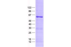 Validation with Western Blot (TADA2L Protein (His tag))