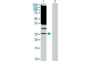 Western Blot analysis of RASL11B expression in transfected 293T cell line by RASL11B MaxPab polyclonal antibody. (RASL11B antibody  (AA 1-248))