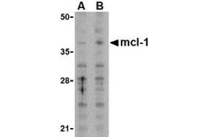 Image no. 1 for anti-Induced Myeloid Leukemia Cell Differentiation Protein Mcl-1 (MCL1) (N-Term) antibody (ABIN207760) (MCL-1 antibody  (N-Term))