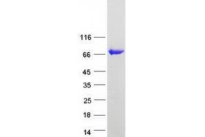 Validation with Western Blot