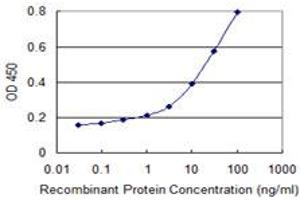 Detection limit for recombinant GST tagged VIL1 is 0. (Villin 1 antibody  (AA 1-77))