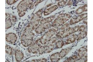 Image no. 1 for anti-Ribosomal Protein S6 Kinase, 90kDa, Polypeptide 6 (RPS6KA6) (AA 636-746) antibody (ABIN599220) (RPS6KA6 antibody  (AA 636-746))