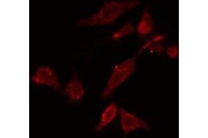 ABIN6274758 staining COLO cells by IF/ICC.