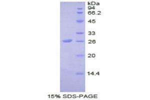 SDS-PAGE (SDS) image for Stromal Cell Derived Factor 4 (SDF4) (AA 154-362) protein (His tag) (ABIN1877464)