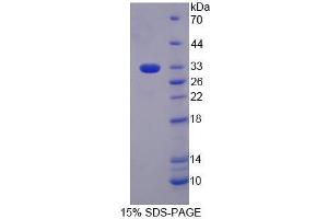 SDS-PAGE analysis of Mouse PGM3 Protein.