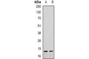 Western blot analysis of Troponin C expression in mouse heart (A), mouse lung (B) whole cell lysates. (Troponin C antibody)