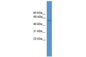 ALDH5A1 antibody used at 0. (ALDH5A1 antibody  (Middle Region))