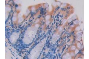 Detection of HEXb in Mouse Colon Tissue using Polyclonal Antibody to Hexosaminidase B Beta (HEXb) (HEXB antibody  (AA 294-435))