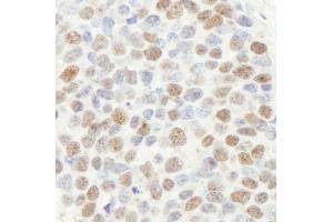 Immunohistochemistry (IHC) image for anti-Mismatch Repair Protein 2 (MSH2) (C-Term) antibody (ABIN7448673) (MSH2 antibody  (C-Term))