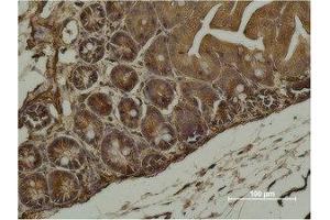 Immunohistochemistry (IHC) analysis of paraffin-embedded Mouse Cecal Tissue using alpha-SMA Monoclonal Antibody. (alpha-SMA antibody)