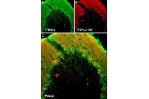 Multiplex staining of TRPC6 and TRPC3 in rat cerebellum - Immunohistochemical staining of rat cerebellum frozen section using Guinea pig Anti-TRPC6 Antibody (ABIN7043826, ABIN7045362 and ABIN7045363) and rabbit Anti-TRPC3-ATTO Fluor-594 Antibody (ABIN7043819). (TRPC6 antibody  (Intracellular))