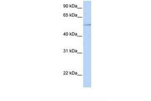 Image no. 1 for anti-HNF1 Homeobox B (HNF1B) (AA 38-87) antibody (ABIN6737705) (HNF1B antibody  (AA 38-87))