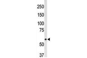 Image no. 1 for anti-5'-Nucleotidase, Ecto (CD73) (NT5E) (AA 1-30), (N-Term) antibody (ABIN357389) (CD73 antibody  (N-Term))