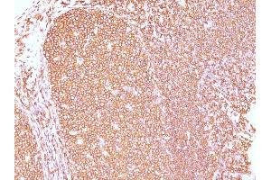 Formalin-fixed, paraffin-embedded human Tonsil stained with CD45RB Mouse Monoclonal Antibody (PD7/26).