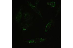 IHC analysis of PPP1R12A using anti-PPP1R12A antibody . (PPP1R12A antibody  (N-Term))