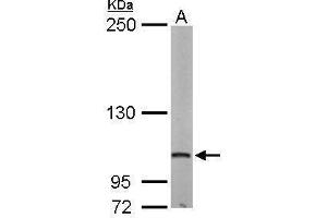 WB Image Sample (50 ug of whole cell lysate) A: Mouse brain 5% SDS PAGE antibody diluted at 1:500 (EIF4G2 antibody  (N-Term))