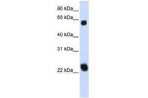 WB Suggested Anti-KLHL26 Antibody Titration:  0. (KLHL26 antibody  (Middle Region))
