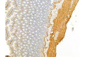 ABIN6254917 and ABIN6267068 at 1/100 staining Rat colon tissue by IHC-P.