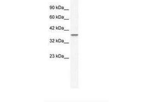 Image no. 1 for anti-Metastasis Associated 1 (MTA1) (AA 601-650) antibody (ABIN203133) (MTA1 antibody  (AA 601-650))