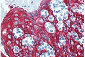 Tonsil, Human: Formalin-Fixed, Paraffin-Embedded (FFPE) (KRT14 antibody  (C-Term))
