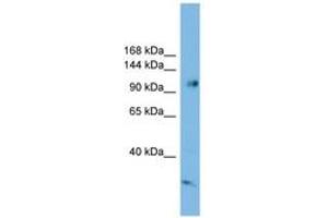 Image no. 1 for anti-Serine/threonine-Protein Phosphatase 4 Regulatory Subunit 3A (SMEK1) (AA 611-660) antibody (ABIN6745202) (SMEK1 antibody  (AA 611-660))