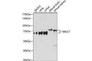 Western blot analysis of extracts of various cell lines, using N Antibody (ABIN6132231, ABIN6144337, ABIN6144339 and ABIN6215418) at 1:3000 dilution. (NAC1 antibody  (AA 170-340))